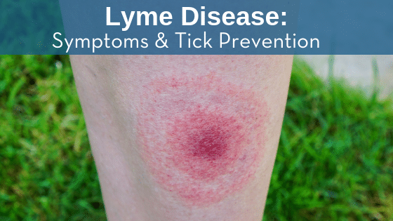 Lyme Disease: Symptoms & Tick Prevention – Test Smartly Labs