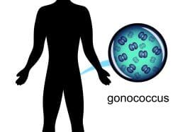 image of gonococcus shown on a silhouette of a person