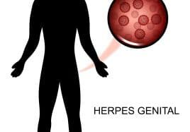 vector illustration of the virus of genital herpes in human