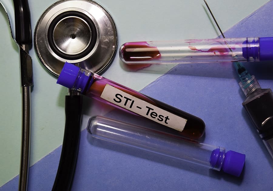 STI STD Blood Vial for Test-min