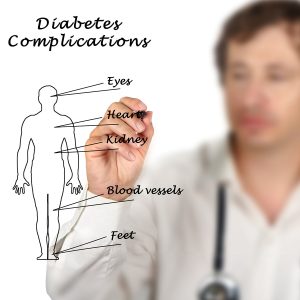 Doctor showing complications from diabetes
