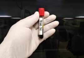 Test tube with blood sample
